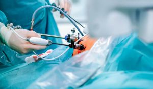  Cirurgia bariátrica: eu posso fazer? Saiba mais sobre o tema